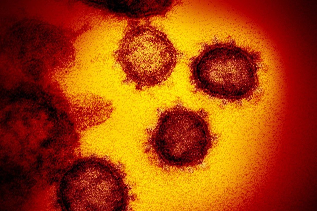 Coronavirus: Union Health Ministry advises Maharashtra, Kerala, and Madhya Pradesh on Delta Plus Variant