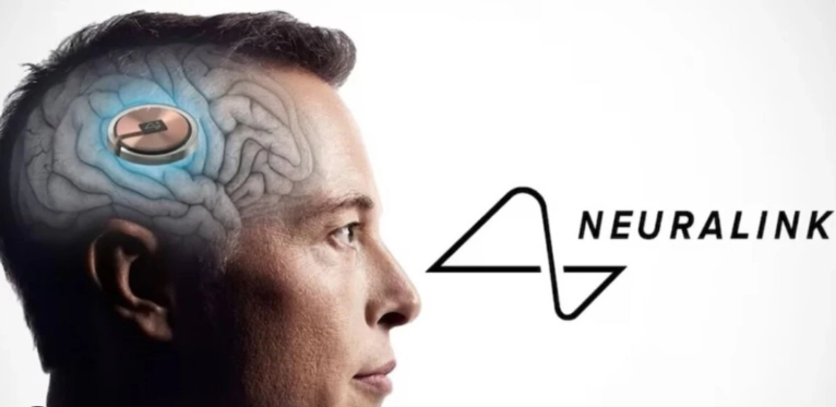 Breakthrough: First human gets brain implant from Musk’s Neuralink