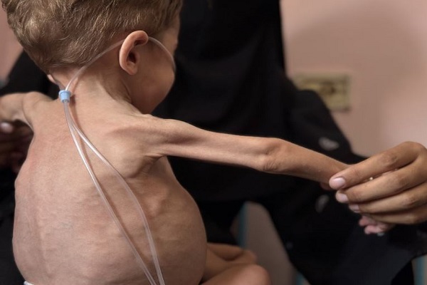 Gaza Declared in State of Famine as Over Half Million Face Catastrophic Conditions