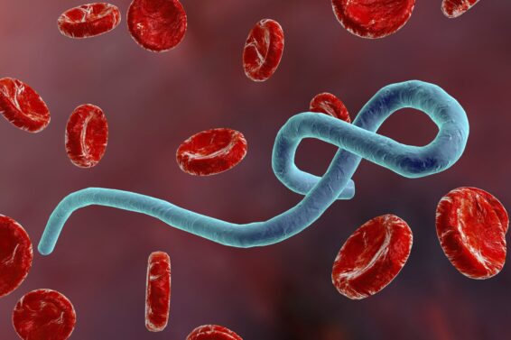 Ebola virus