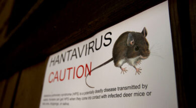 Hantavirus