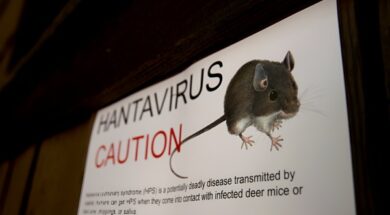 Hantavirus