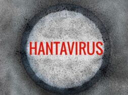 Hantavirus