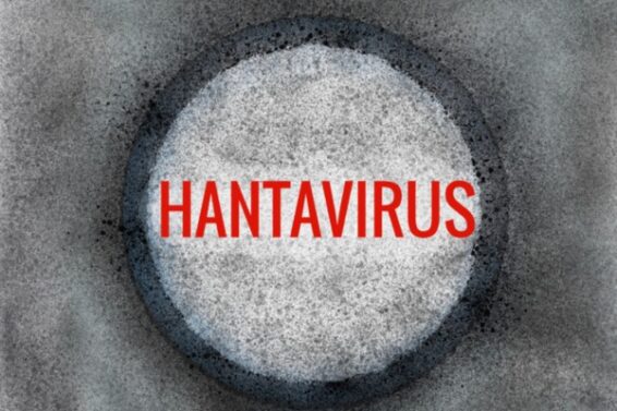 Hantavirus