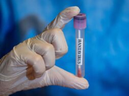 Hantavirus