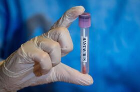 Hantavirus