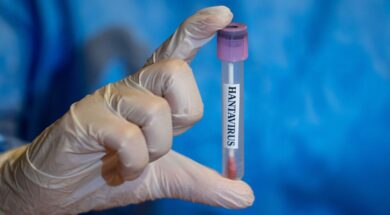 Hantavirus