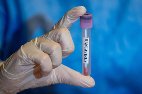 Hantavirus