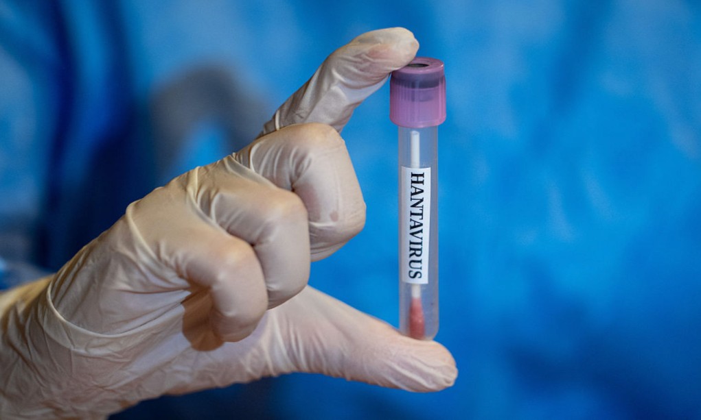 One US citizen tests mildly positive for hantavirus, another has mild symptoms